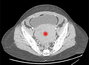 Question 1 answer - Image B