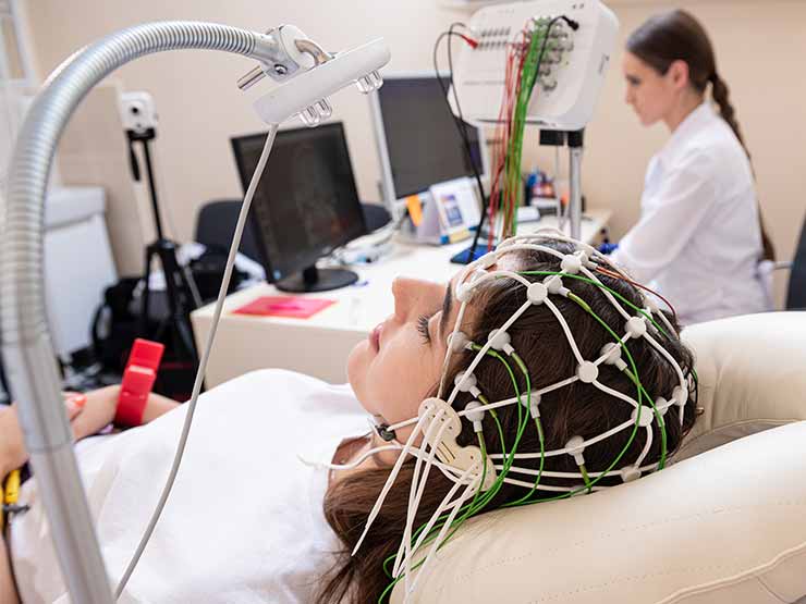 A young woman with electrodes on her scalp getting EEG readings for epilepsy.