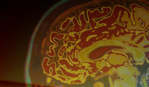 Innovations in Review: Neurology and Neurosurgery