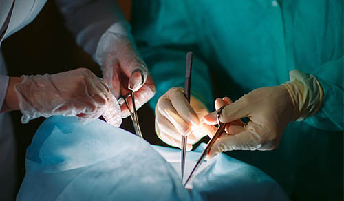 Innovations in Review: Transplant