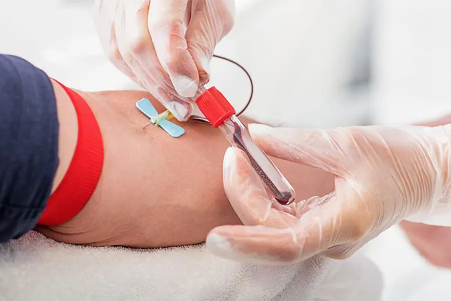 A neurologist explains the promise of the first FDA-approved blood test for diagnosing Alzheimer’s disease and how it works.